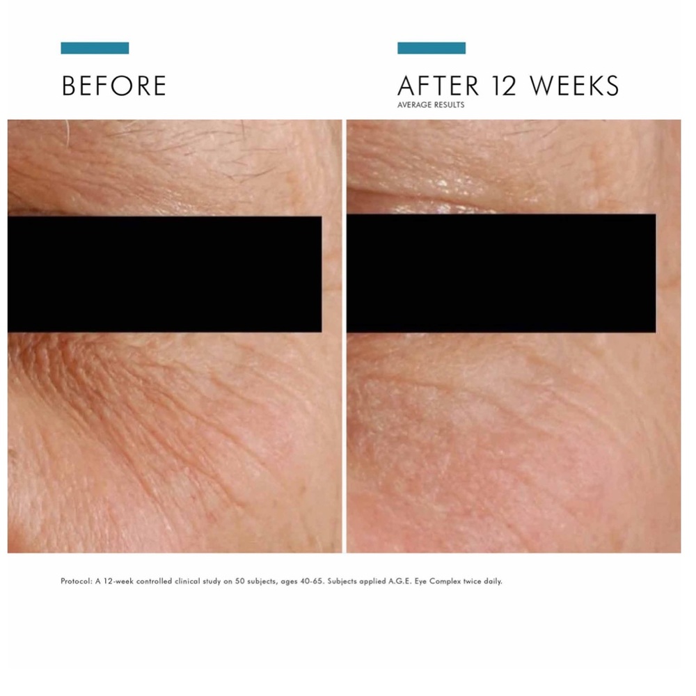 SKINCEUTICALS A.G.E. ADVANCED EYE FOR DARK CIRCLES BRAND NEW NEVER SEALED - Picture 5 of 6